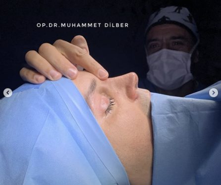 Burun Estetiği - Op. Dr. Muhammet Dilber
