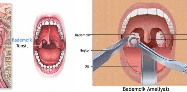 Bademcik ve Geniz Eti - Op. Dr. Muhammet Dilber